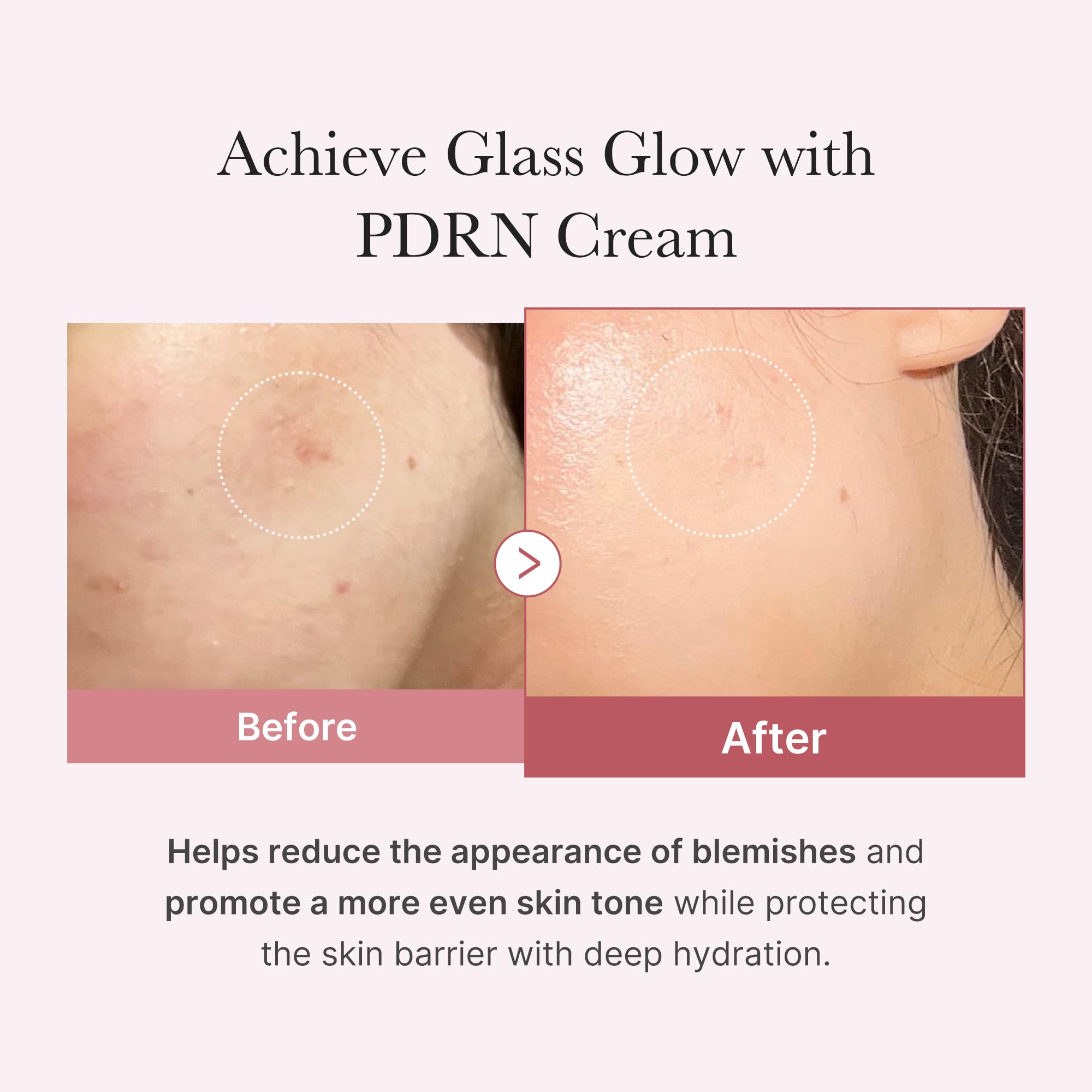medicube Salmon DNA PDRN Pink Hyaluronic Moisturizing Cream | Blemish Relief & Hydrating Care | Restores Skin Elasticity & Glow | Korean Skincare, Even Skin Tone & Pore Care | 50ml / 1.69 fl.oz.