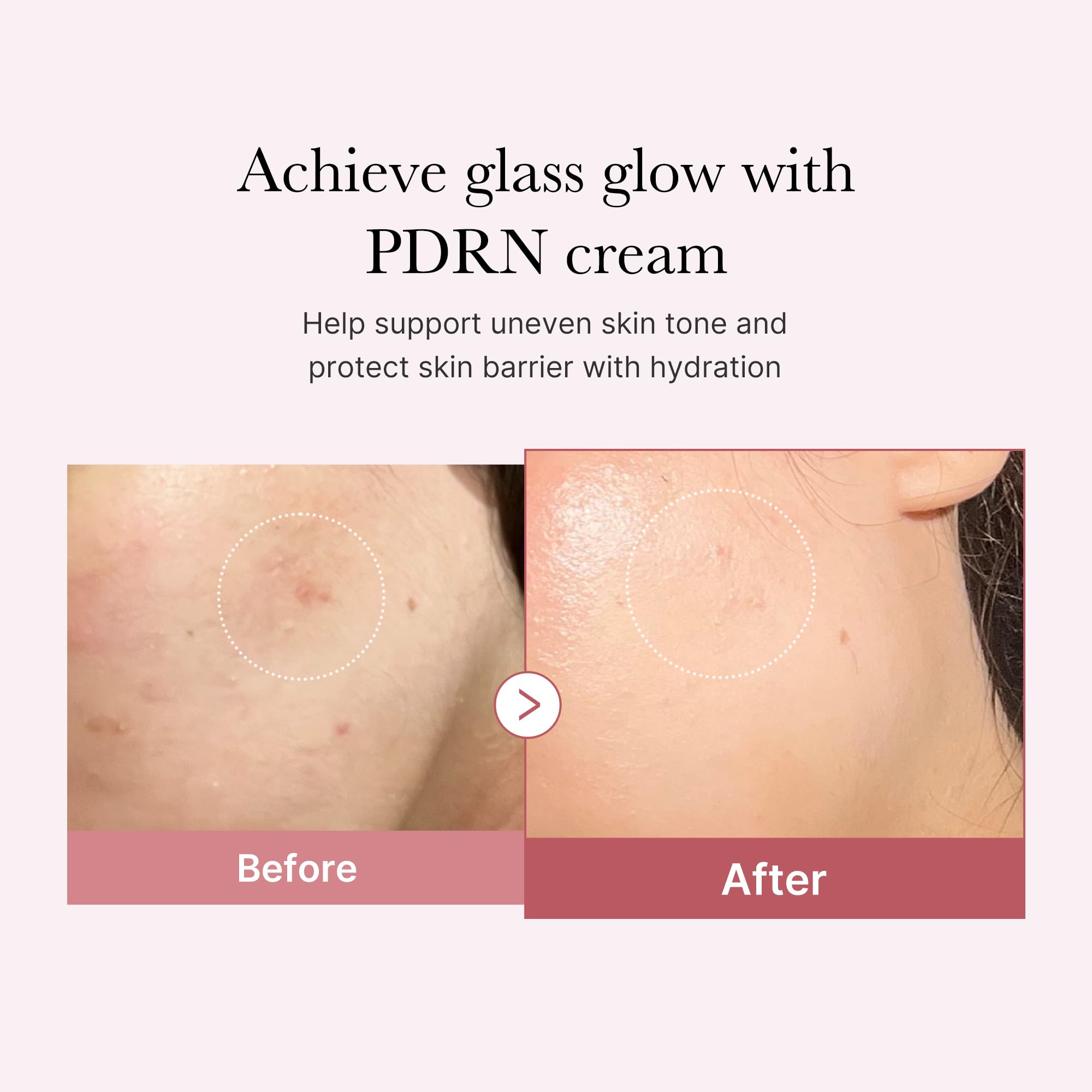 medicube Salmon DNA PDRN Pink Hyaluronic Moisturizing Cream | Blemish Relief & Hydrating Care | Restores Skin Elasticity & Glow | Korean Skincare, Even Skin Tone & Pore Care | 50ml / 1.69 fl.oz.